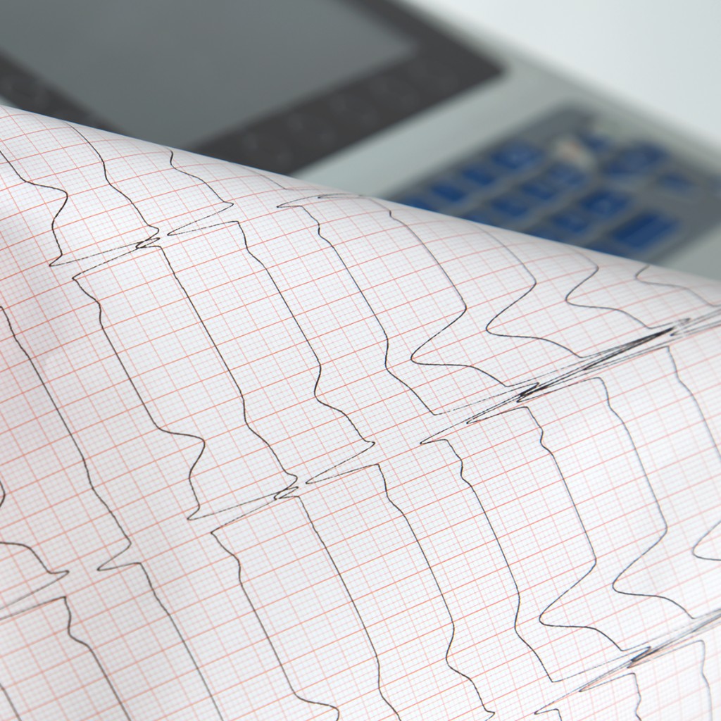 ECG waveforms on gridded thermal paper from the Cardiovit AT-102 G2; blurred unit in the background — cardiac report output.